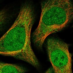Deoxycytidylate deaminase Antibody, Novus Biologicals 0.1mL; Unlabeled:Antibodies,